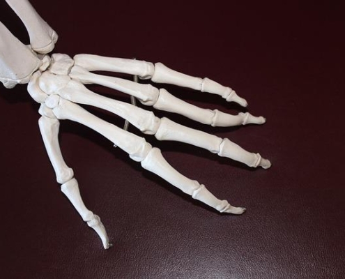 5 Essential Tips for Balancing Arthritis and Exercise